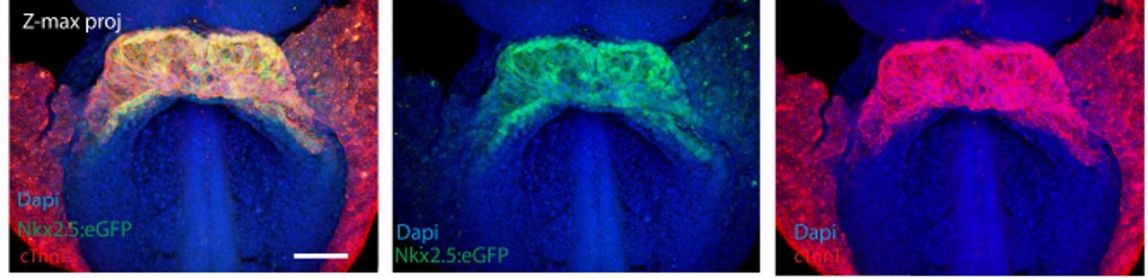 Visualizing embryonic heart formation in real time: